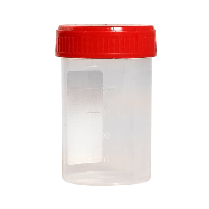 Eurocare universaalne uriiniproovitops 60 ml-1