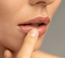 Kuidas vältida huulte kuivust ja lõhenemist talvel