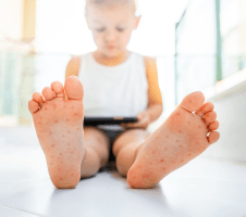 Enteroviirus: sümptomid, ravi ja ennetus