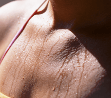 Suvine kehahooldus: püsi värske ja ohja higistamist