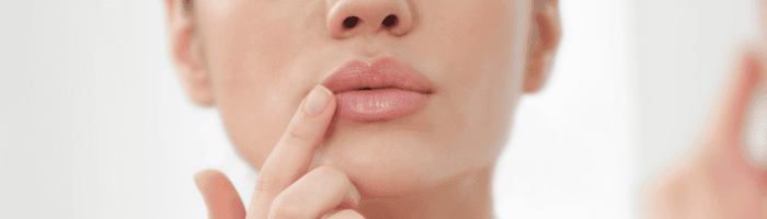 Kuidas vältida huulte kuivust ja lõhenemist talvel