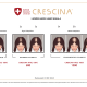Crescina Transdermic HFSC 500 ампулы для женщин 20шт 3.5 мл